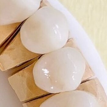 isakovic-dental_protetika-example191024.jpg